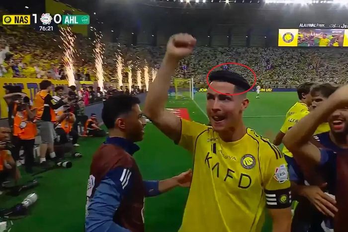 Chiếc vòng đen bí ẩn trên đầu Ronaldo