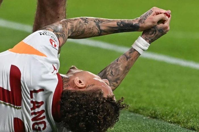 Tiền đạo người Hà Lan đứt lìa đầu ngón tay khi đá Champions League