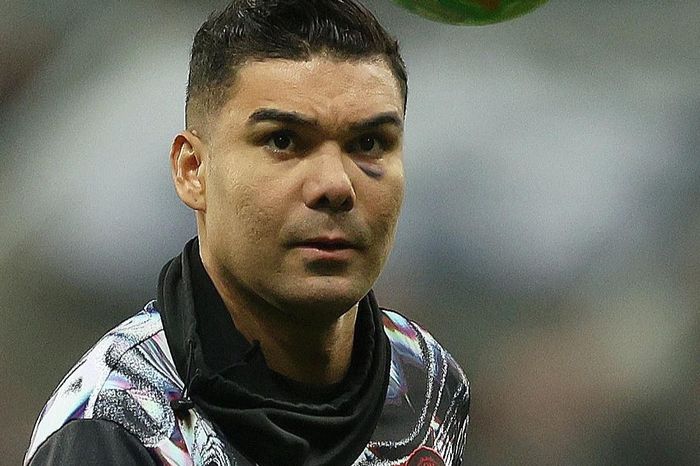 Vì sao mắt Casemiro bị bầm tím?